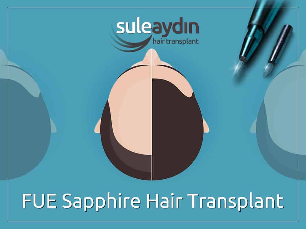 FUE Sapphire Hair Transplant