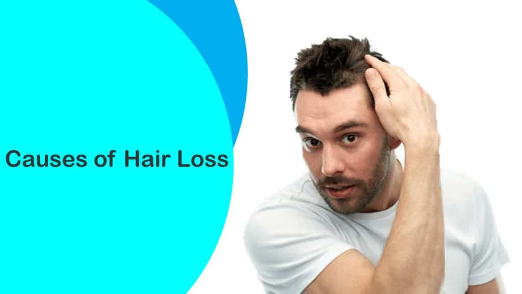 15 Leading Causes of Hair Loss in Men and Women You May Not Know