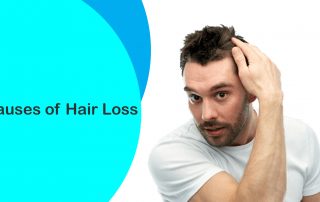 15 Leading Causes of Hair Loss in Men and Women You May Not Know