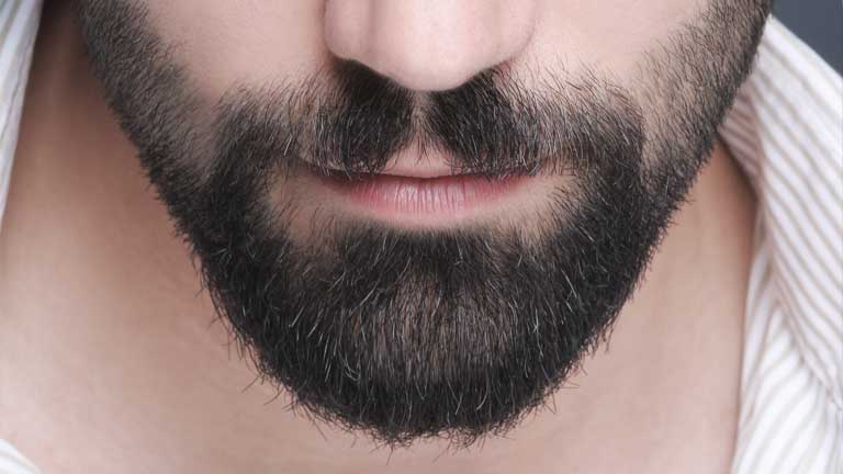 How Beard Transplants Work?